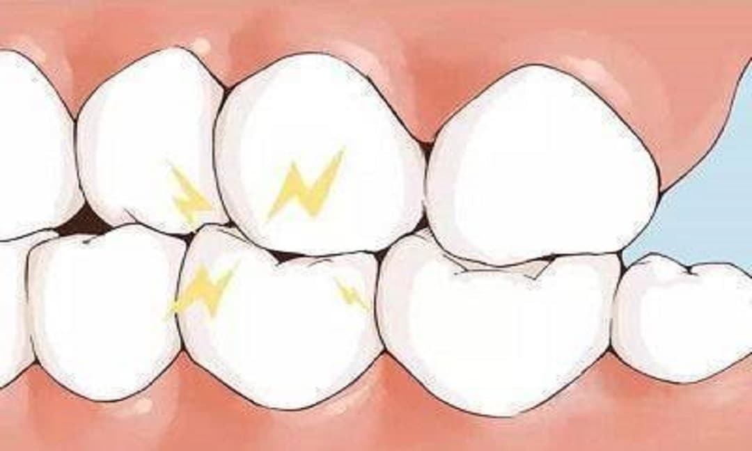 Bệnh gan, tiên tri răng? Nếu có 2 loại bất thường trên răng, có thể gan đang “kêu cứu”